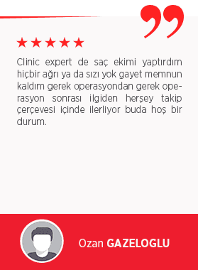 Hair Transplant Hair Transplant