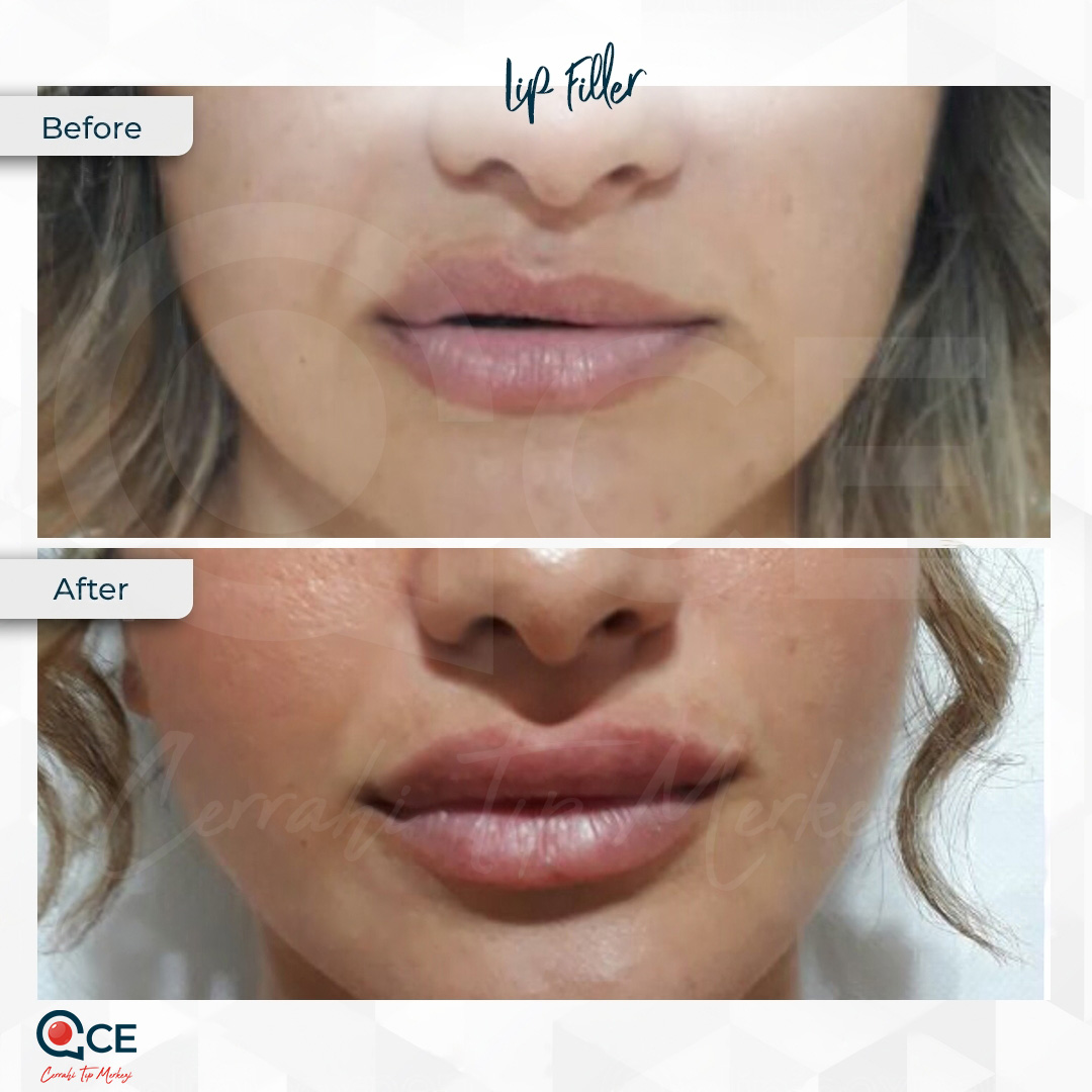 Ce Tıp Merkezi Aesthetic