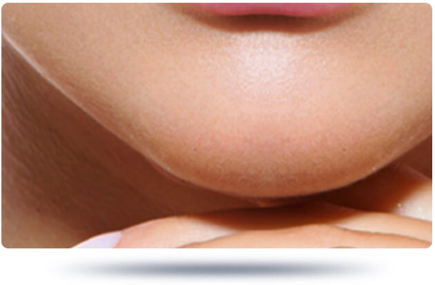 شفط دهون الذقن تجميل الذقن