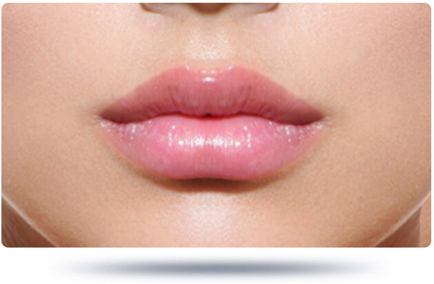 فيلر والوجه تجميل الشفاه