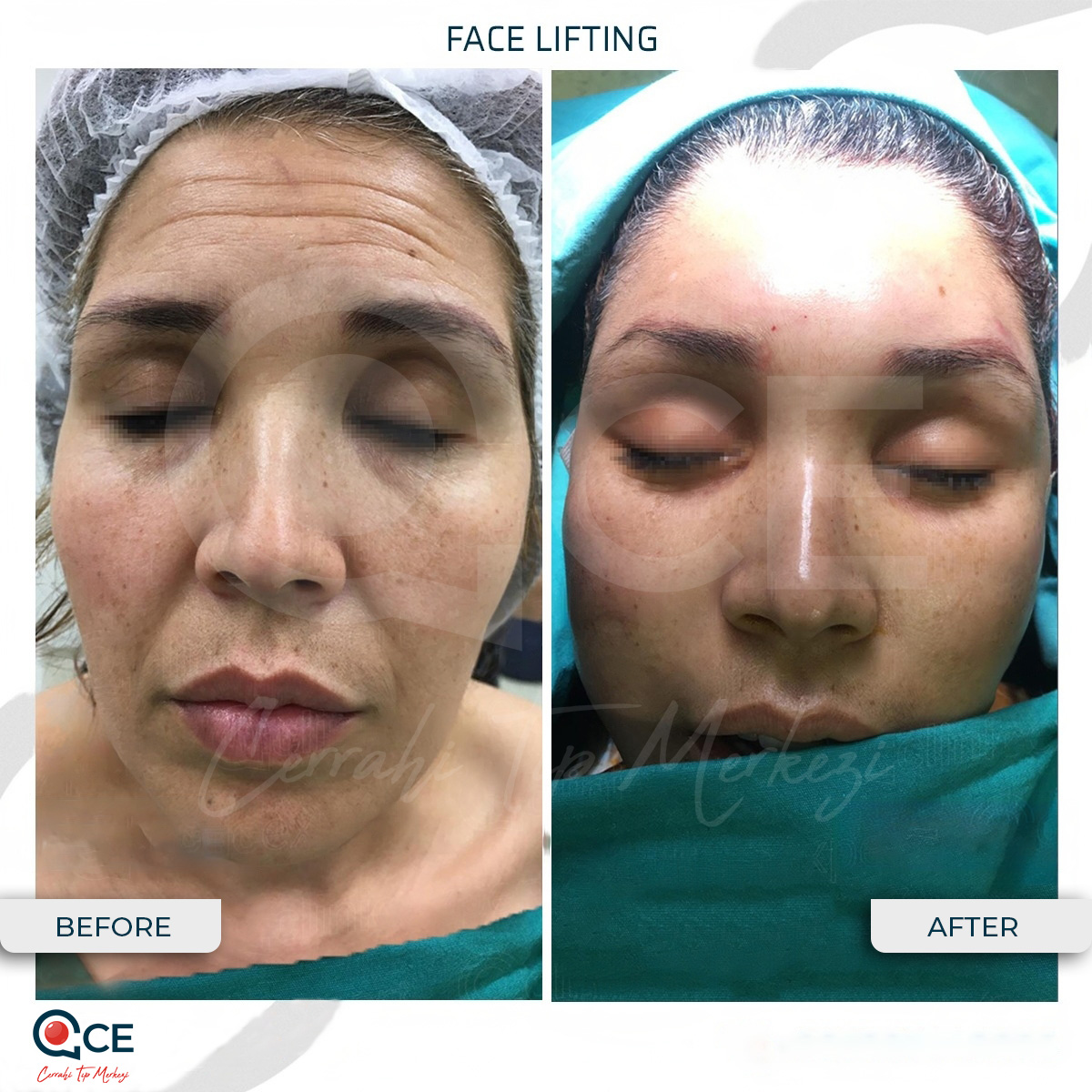 CCE Tıp Merkezi Aesthetic