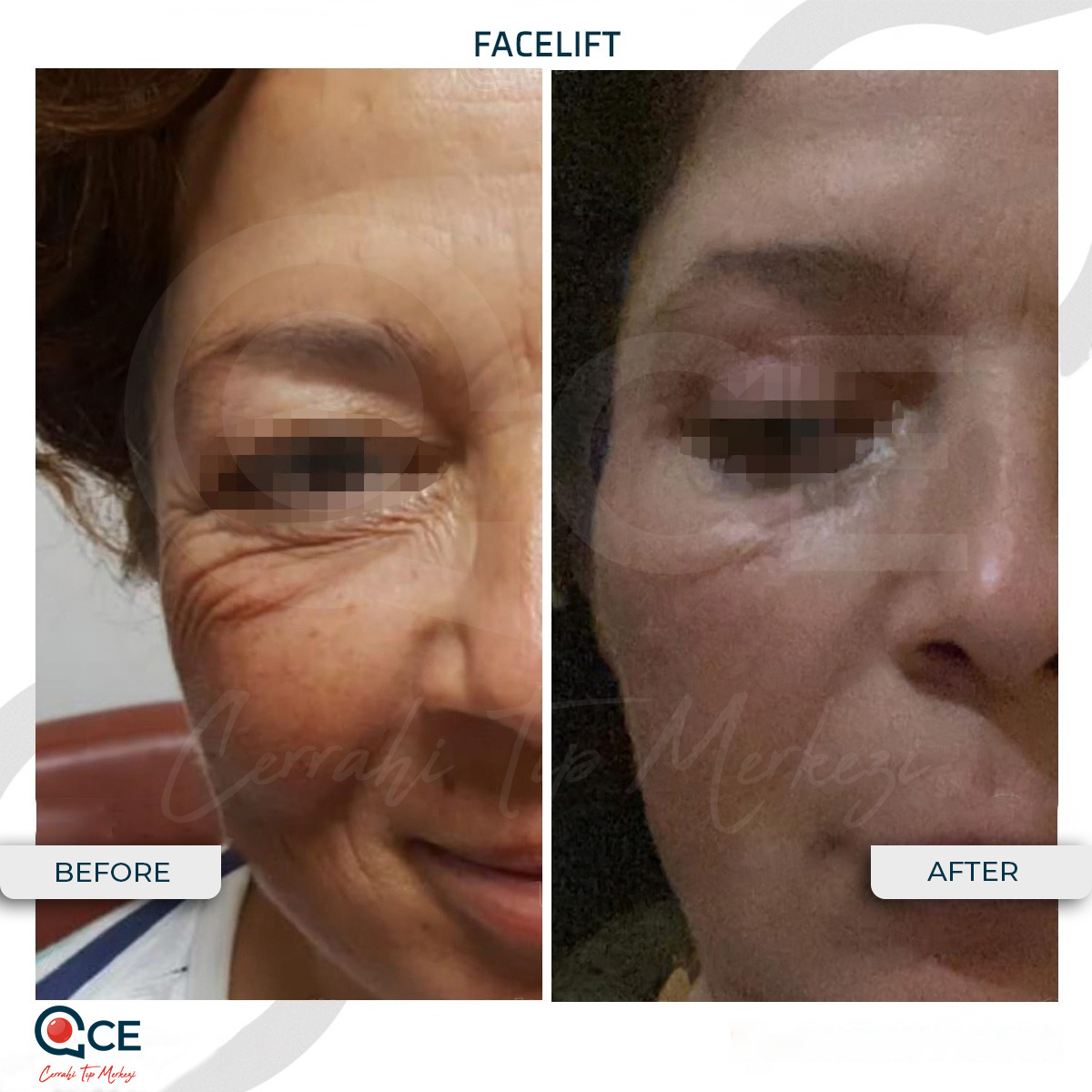 CE Tıp Merkezi Aesthetic