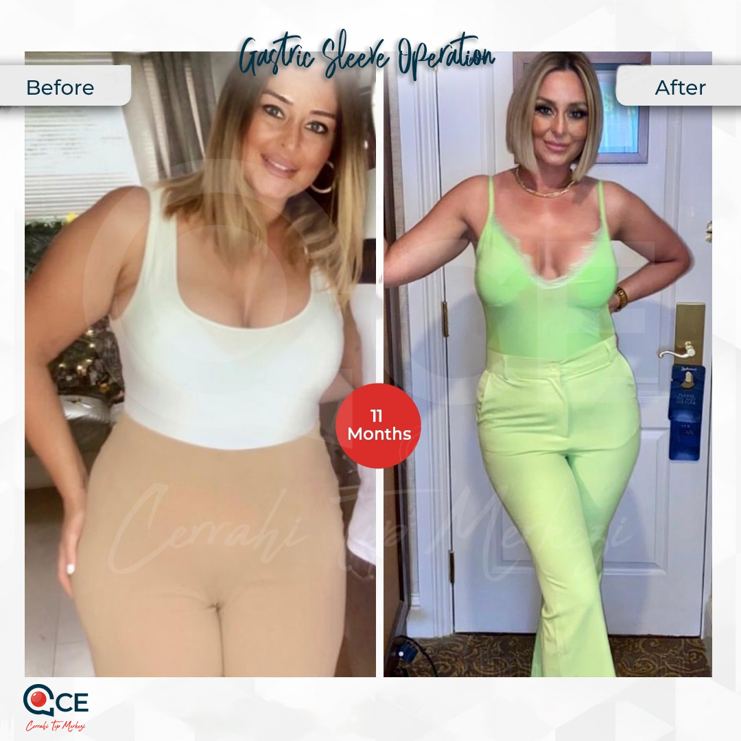 CCE Tıp Merkezi Aesthetic