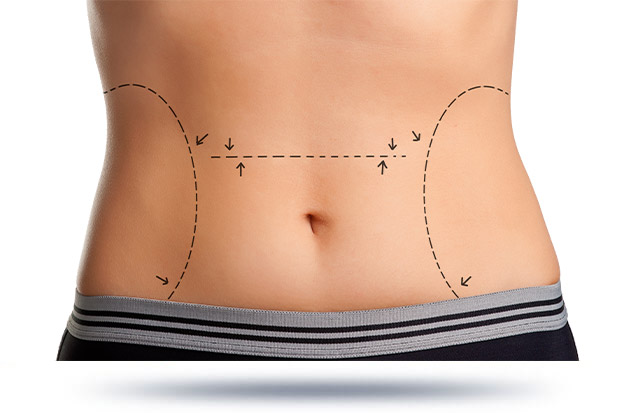 Non-surgical weight loss procedures