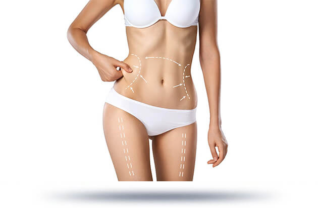 ballon intragastrique