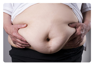 TÜP MİDE AMELİYATI